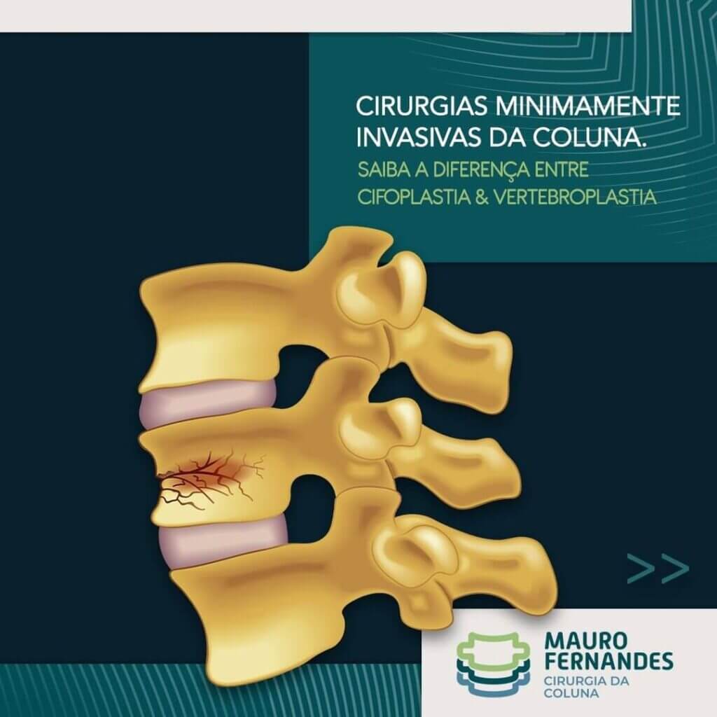 Dr Mauro Fernandes cirurgia  da coluna tratamento da dor