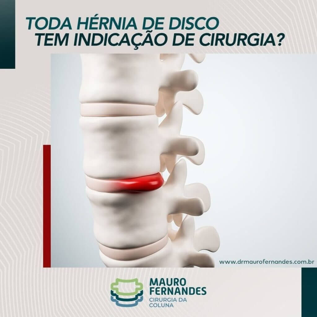 cirurgia de hérnia de disco